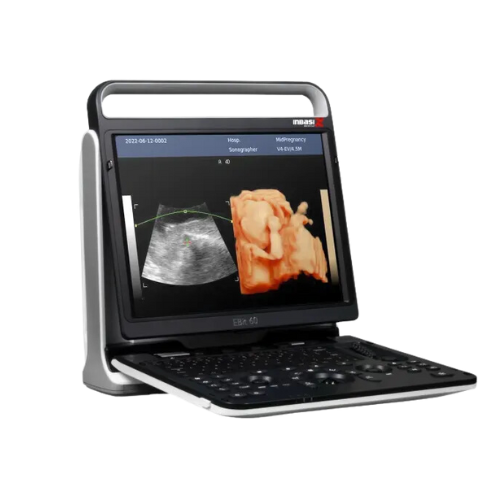 Ultrasonido EBIT 60 – DISTRIBUIDOR DE LABORATORIOS Y HOSPITALES